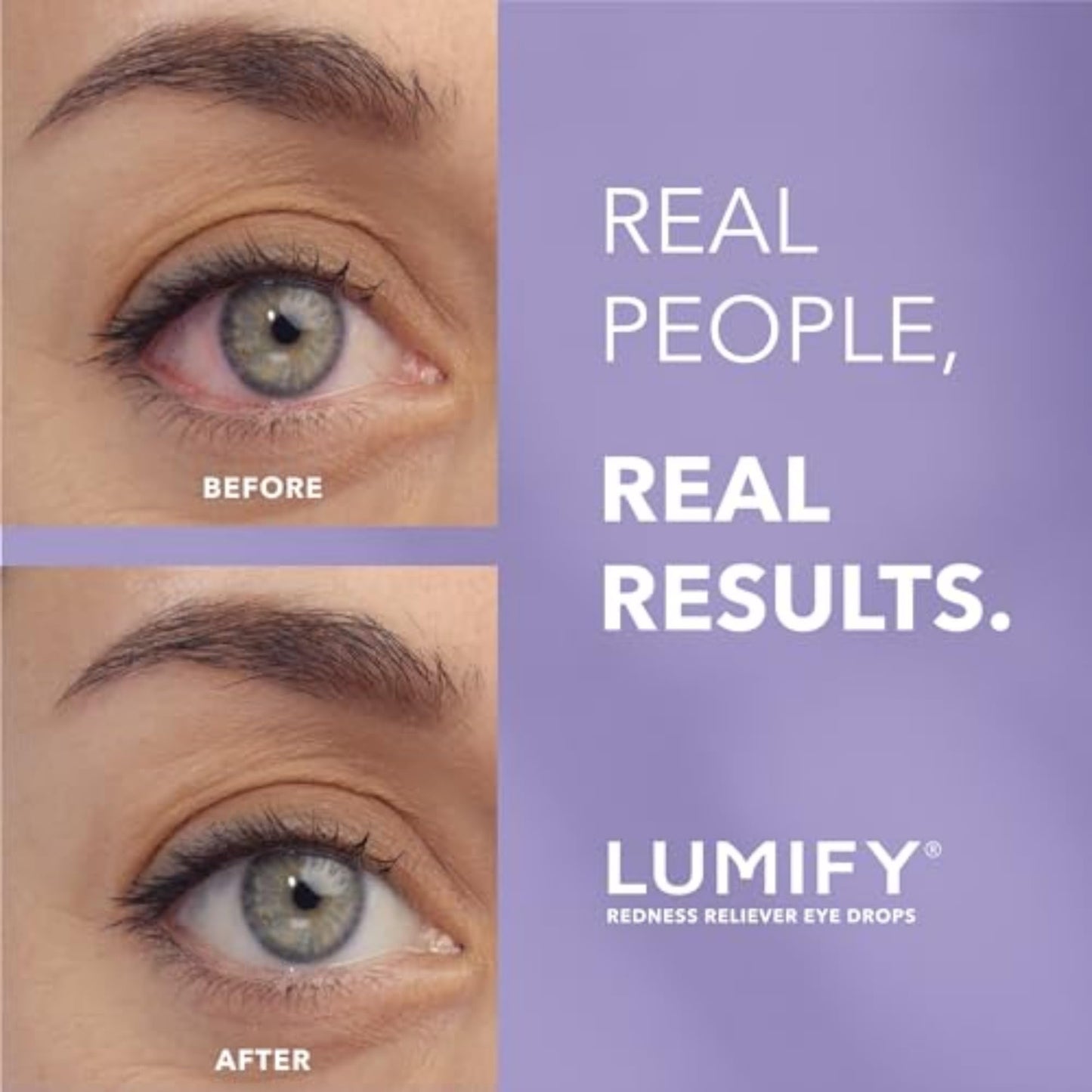 LUMIFY Redness Reliever Eye Drops, for Whiter & Brighter Looking Eyes, 0.08 Fl Oz (2.5 mL)