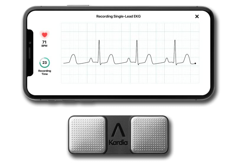 KardiaMobile 1-Lead Personal EKG Monitor – Record EKGs at Home – Detects AFib and Irregular Arrhythmias – Instant Results in 30 Seconds – Easy to Use – Works with Most Smartphones