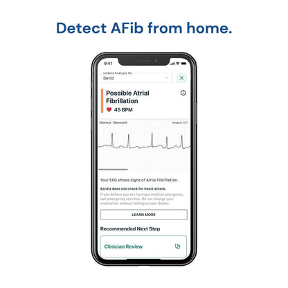 KardiaMobile 1-Lead Personal EKG Monitor – Record EKGs at Home – Detects AFib and Irregular Arrhythmias – Instant Results in 30 Seconds – Easy to Use – Works with Most Smartphones