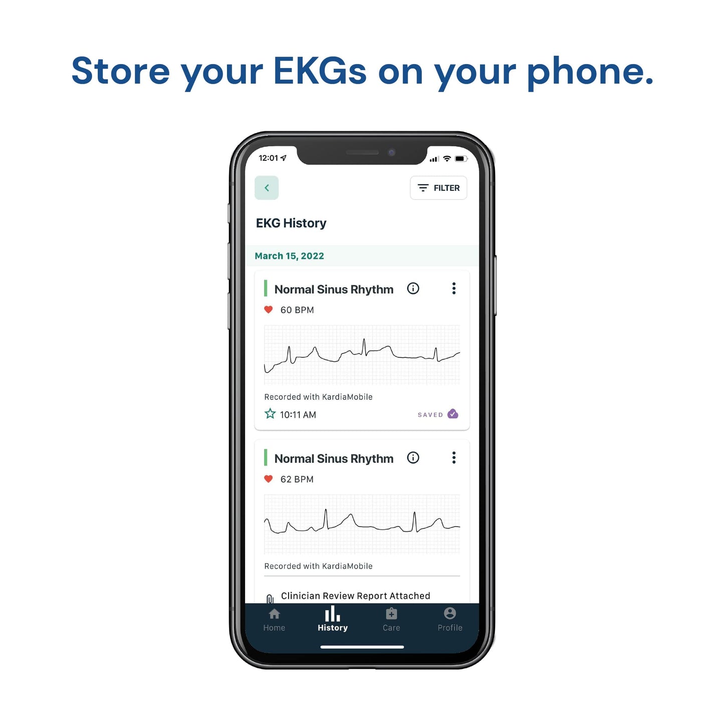 KardiaMobile 1-Lead Personal EKG Monitor – Record EKGs at Home – Detects AFib and Irregular Arrhythmias – Instant Results in 30 Seconds – Easy to Use – Works with Most Smartphones