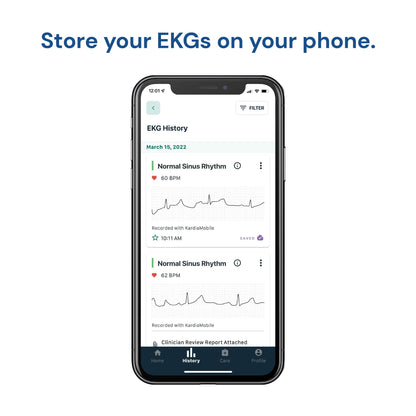 KardiaMobile 1-Lead Personal EKG Monitor – Record EKGs at Home – Detects AFib and Irregular Arrhythmias – Instant Results in 30 Seconds – Easy to Use – Works with Most Smartphones