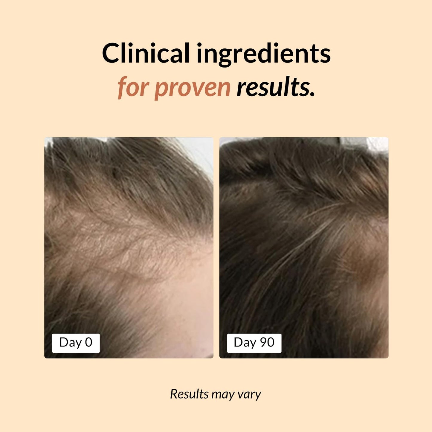 FullyVital Hair Growth Supplement for Women, Ages 35 and Up, Science-Backed Hair Vitamins for Thicker, Fuller Hair with Biotin, Saw Palmetto - Dermatologist Recommended (1 Month Supply, Vegan)