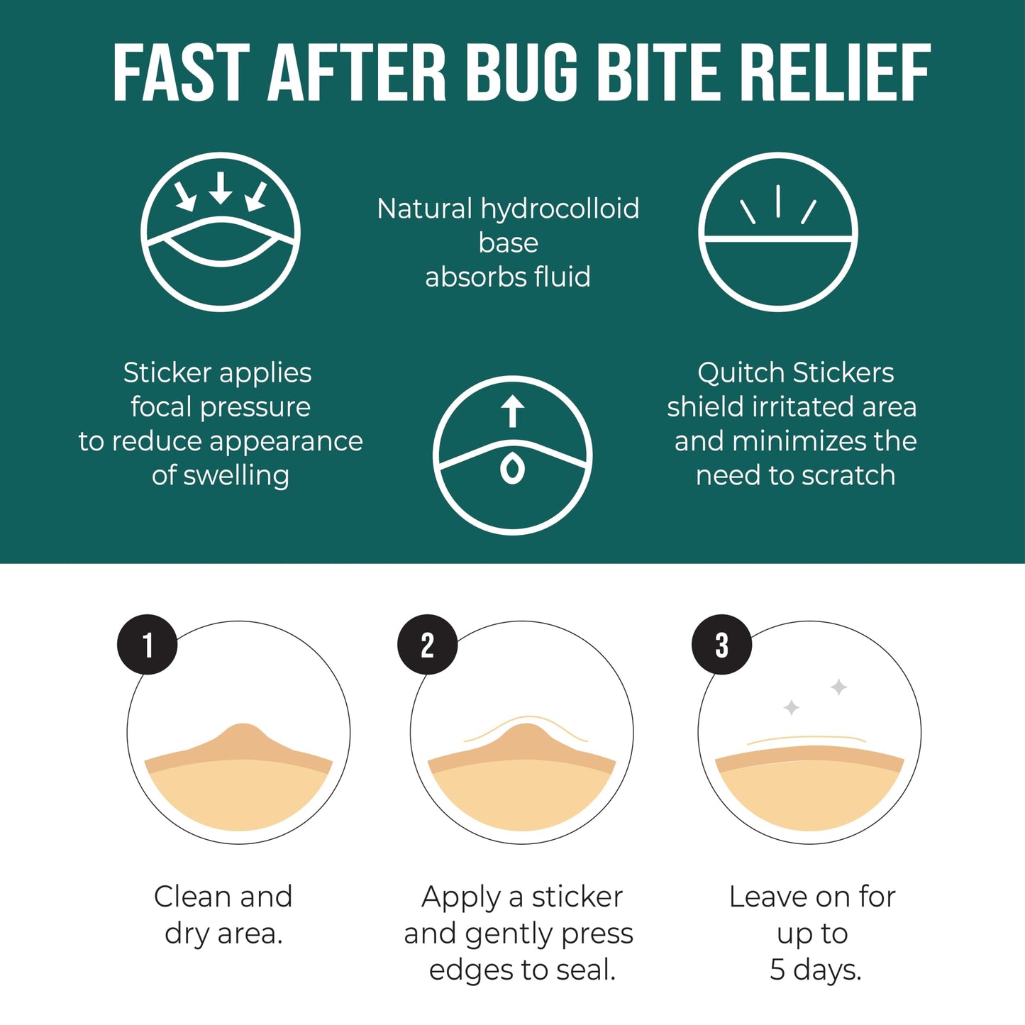 Quitch Mosquito Bite Itch Relief Patch, After Bite Insect Bite Treatment, Anti Itch Cream Alternative, Insect Bite Relief, Cruise, Travel and Camping Essential for Kids