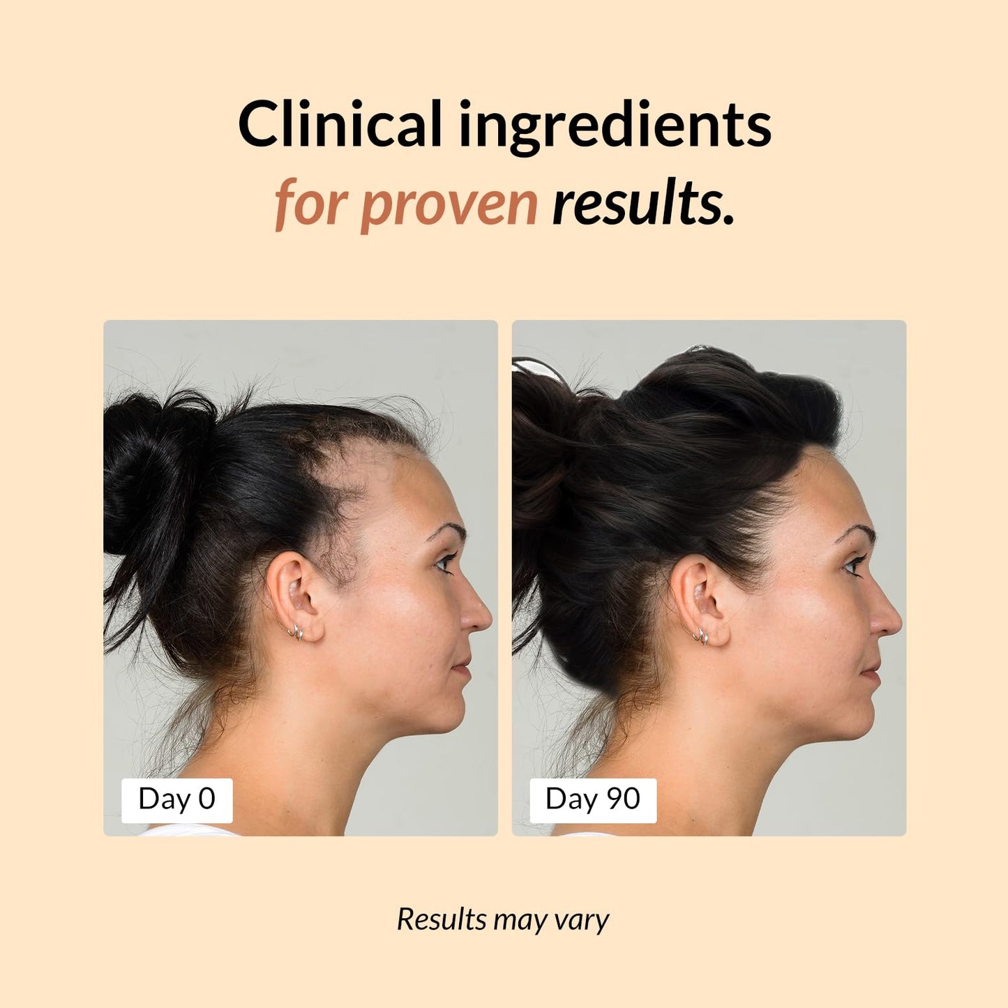 FullyVital Hair Growth Supplement for Women, Ages 35 and Up, Science-Backed Hair Vitamins for Thicker, Fuller Hair with Biotin, Saw Palmetto - Dermatologist Recommended (1 Month Supply, Vegan)