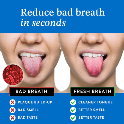 Mouthology Tongue Scraper for Adults (2 Pack), Reduce Bad Breath, Metal Tongue Scraper, Tongue Cleaner, Tongue Scraper, Stainless Steel Tongue Scraper, Tongue Cleaner for Adults, Tongue Scrubber