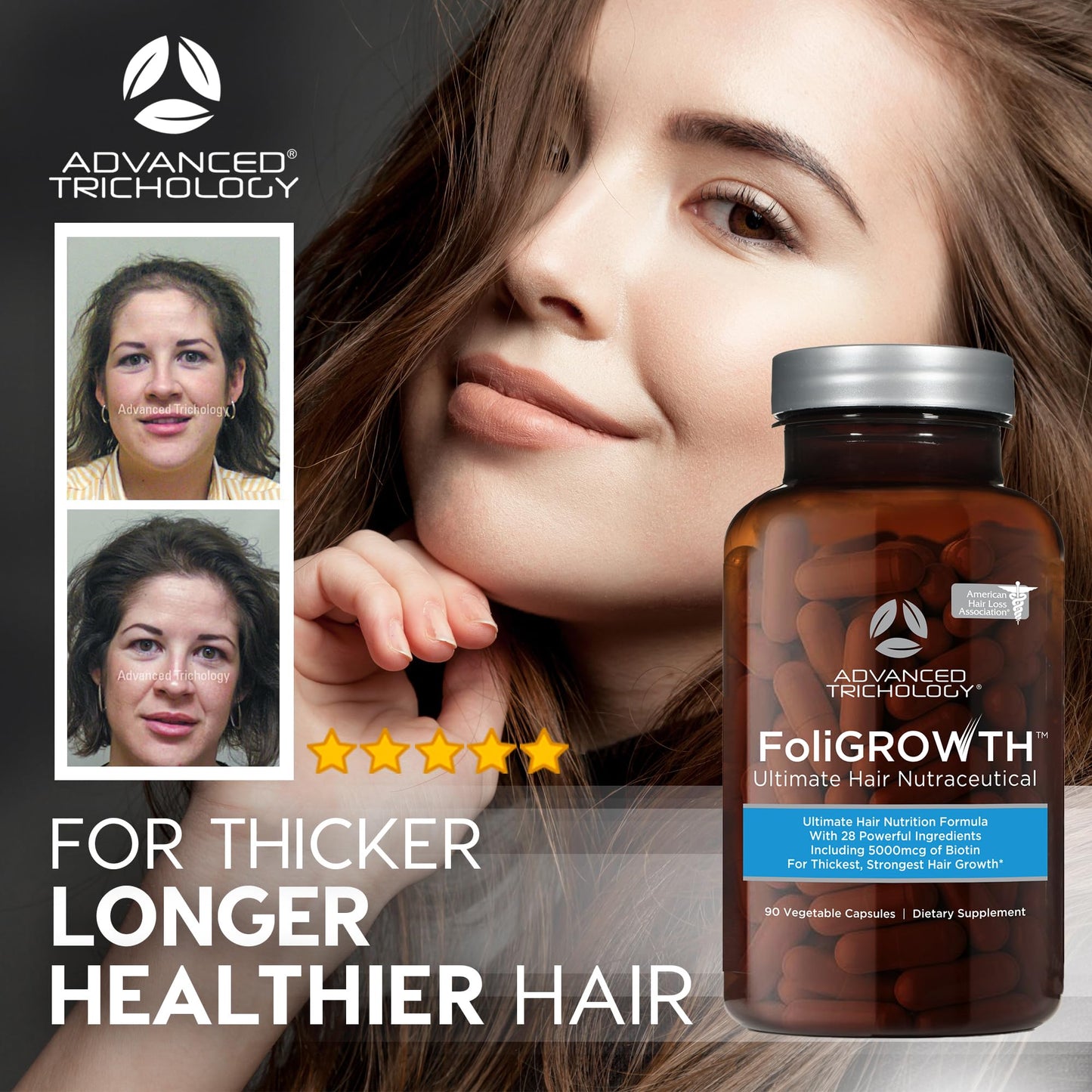 Advanced Trichology FoliGROWTH™ Hair Growth Supplement for Thicker Fuller Hair | Approved* by the American Hair Loss Association | Revitalize Thinning Hair - 90 Count (Pack of 1)